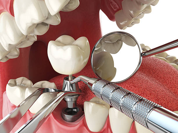 Best After-Hours Emergency Dentist in Alexandria, LA