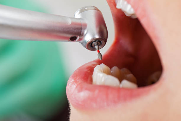 Best Emergency Dental Care for Trauma or Injury in Alexandria, LA